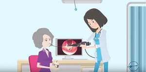 Swallow Study In New York | New York Mobile Flexible Endoscopic Evaluation Of Swallowing