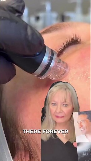 HydraFacial Explained | Instant Glow with Zero Downtime at K2 Restorative Medicine