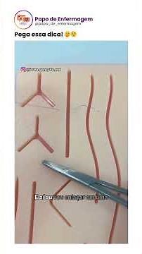 Como fazer uma sutura simples