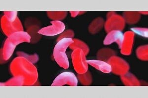 The Sickle Cell Unit: ‘We care’ - Jamaica Observer