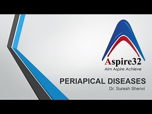 Periapical Diseases Simplified !