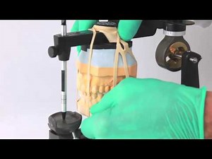 Utilization of FlexiMount™ When Mounting Casts to an Articulator With a Thumb Screw