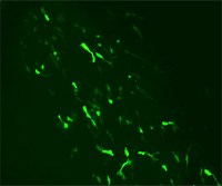 Cell Motility and Migration, Cell Invasion and Chemo-attraction