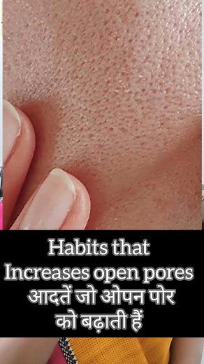 1.8K views | Skincare Habits that increases Open pores Change them...