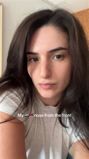 Understanding Middle Eastern and Armenian Nose Shapes