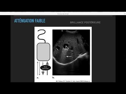 Physique des ultrasons