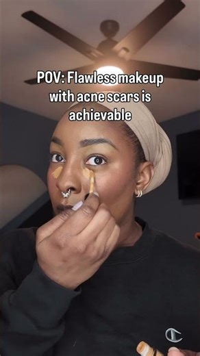 Flawless Makeup with acne scars are achievable!