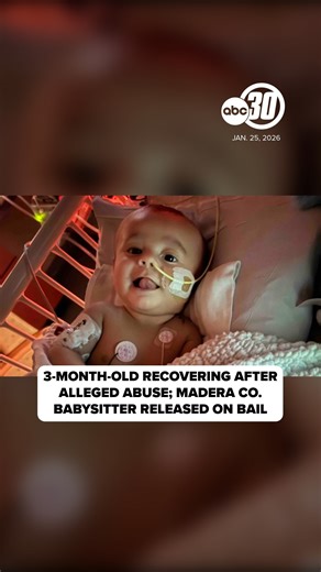 Three-month-old Braxton Musselman is recovering this morning at Valley Children's Hospital after suffering severe head trauma at the hands of his babysitter, now an accused child abuser. | ABC30 Action News