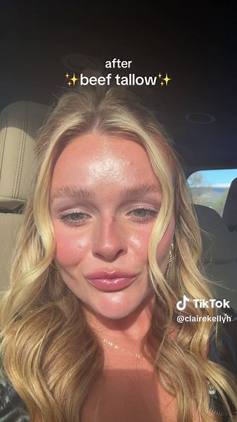 Beef Tallow for Clear Skin: Before and After Results