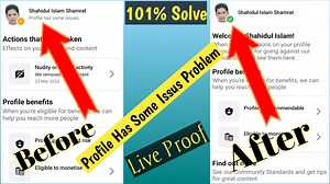 Profile Has Some Issues Remove | How to Remove Profile Has Some Issues in Facebook #profilehassomeissue | Technical Ziko