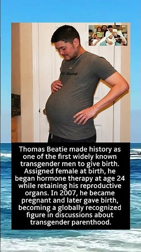 Thomas Beatie: The Man Who Made History by Giving Birth 😮 | Incredible True Story #shorts