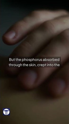 She Was Rotting Alive and Her Boss Didn't Care #British #History #IndustrialRevolution #Victorian