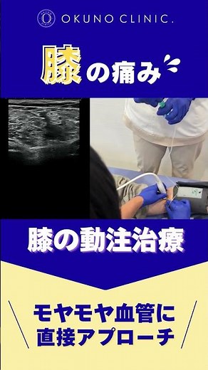 For knee pain that won't go away