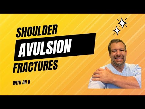 Shoulder Fractures: Causes, Treatment, and Recovery Explained by an Expert