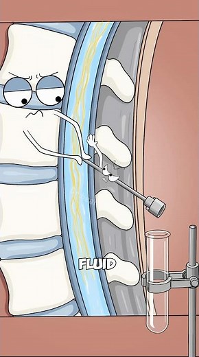 Why Did They Take Fluid From His Spine?