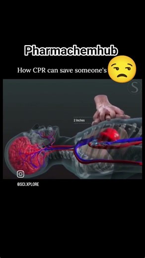 cpr procedure step by step | cpr| cpr machin| #viral #shortsvideo #shorts