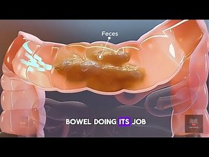 "Healthy vs Obstructed Bowel: Peristalsis Breakdown | 3D Medical Animation"