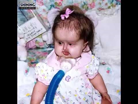 The people who look like aliens 👽