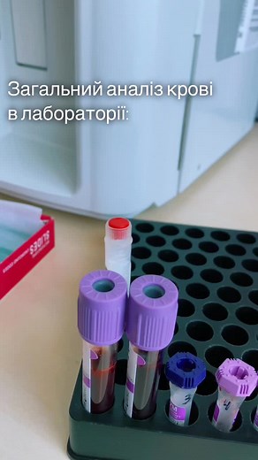 #улюбленасправа#кров#робота #медицина #гетьзукраїни #украінанайкраща🇺🇦💪 #українськийтікток @Jerry Heil