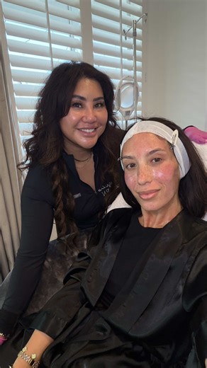 Transform Your Skin with Microneedling and PRP Treatment
