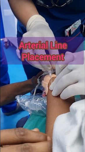 Arterial line placement