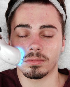 4.7K views · 25 reactions | LED light therapy is the KEY to glowing skin! See for yourself! | Cuff-Zoned | Facebook
