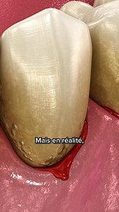 Chez MyVariations, nous avons repensé votre routine de brossage pour la rendre exceptionnelle ✨ -- Nos brosses à dents soniques sont recommandées par les chirurgiens-dentistes de l'Union Française pour la Santé Bucco-Dentaire 🦷 -- Imaginez : 40 000 vibrations par minute qui nettoient vos dents en profondeur, tout en douceur, pour atteindre les endroits les plus difficiles sans agresser votre émail ou vos gencives 🪶 -- Trouver notre brosse est un jeu d'enfant, que ce soit sur www.myvariations.c