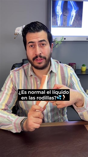 Es normal el líquido en las rodillas? 💦🦵🏻 #drravelo #Traumatólogo #ortopedia #médico #huesos
