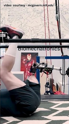 This Bionic Limb Can Feel and Move Like the Real Thing