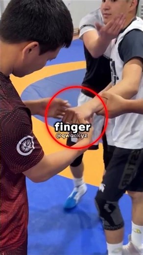 He dislocated his finger