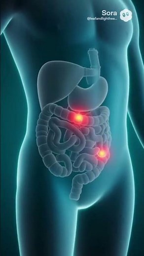 Appendectomy in 10 Seconds | 3D Medical Animation #shortvideo