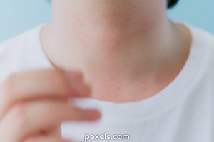 Aids Videos, Download The BEST Free 4k Stock Video Footage & Aids HD Video Clips