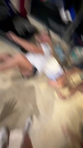 Mild Concussion and Jaw Injury: Dance Challenge Fail