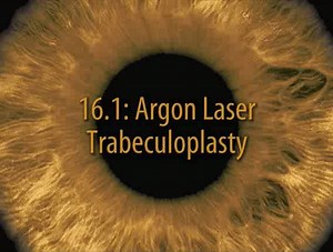 Surgical Techniques in Ophthalmology Series: Glaucoma Surgery 16. Argon laser trabeculoplasty Jacob T. Wilensky #Glaucoma_Surgery #Glaucoma | Piece of ophthalmology