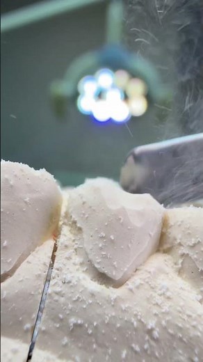 #dentalcare #dentistry #dentist #dentalclinic #satisfyingvideo #teethwhitening #dentalshorts #jazz