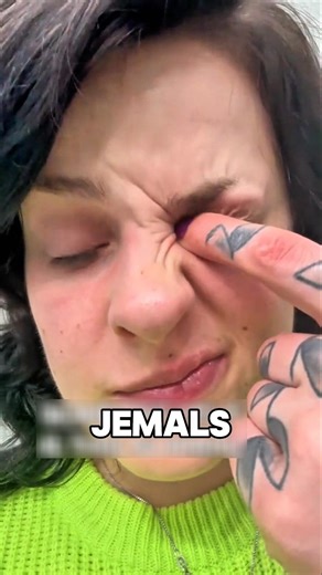 Why does your eye make a strange noise when you press on it?