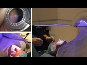 London Vision Clinic | LASIK | Live laser eye surgery | Professor Dan Reinstein