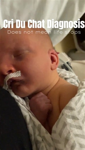 S A R A on Instagram: "#criduchat #criduchatawareness #criduchatsyndrome #genetics #diagnosisjourney"