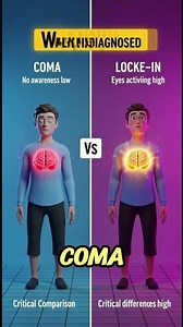 Fully Conscious but Can’t Move!? 😱 | Locked-In Syndrome Explained