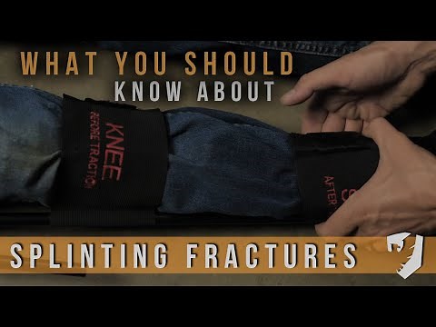 Splinting Fractures - Vacuum splints, traction splints, improvising and more