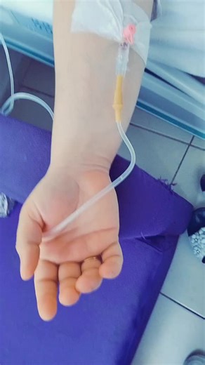 Understanding IV Lines: A Close-Up Look at Usage