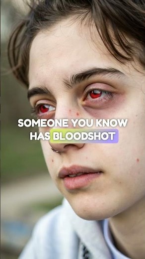 The Hidden Dangers of Air Duster Abuse | What You Need to Know #addictionrecovery