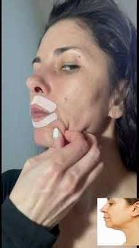 Lifting du bas du visage | Redessiner la mâchoire naturellement