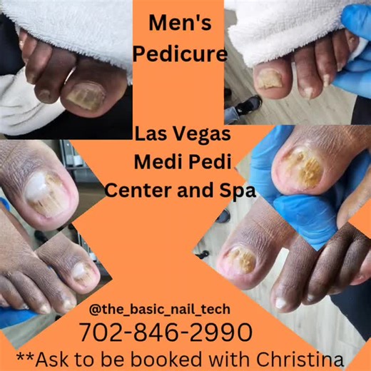 Men's Safe Medical Pedicures at Las Vegas Medi Pedi Center