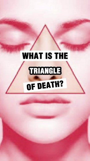 Pop with caution! 🚫 … Messing with pimples in the ‘triangle of death’ on the face can lead to serious complications. … This dangerous zone, spanning from the nose to the corners of the mouth, is close to vital blood vessels. … Infections here can spread, risking serious complications. … Always consult a dermatologist before taking action. … #SkincareSafety #pimple #acne #pimples #blackheads #skincare #pimplepopper #brownsanatomy @Sandra Lee, MD