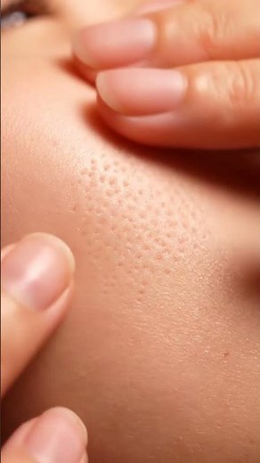 “Ultra Macro Filament Extraction | Watch Every Worm Slide Out Cleanly”