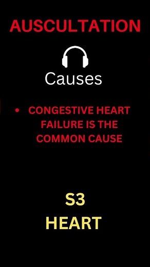 S3 Abnormal Heart Sound - Auscultation #medicine #medstudent #usmle #plab #cardiology