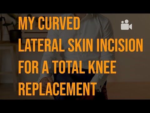 The lateral curve incision for a knee replacement