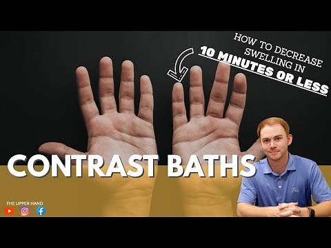 SWOLLEN HAND?? Reduce EDEMA in 10 minutes or LESS!