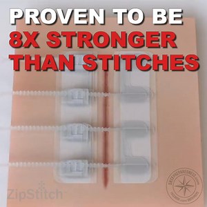 Have you added ZipStitch to your first aid kit yet? Find it here! ➡️ https://amzn.to/2YePwA4 . We may earn a small commission (at no cost to you!) from the above link | SHTF Prepping & Homesteading Central